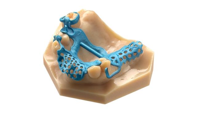 Dental 3D Printing Pros Cons